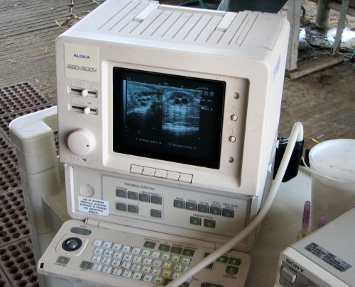 Ultrasound Unit.