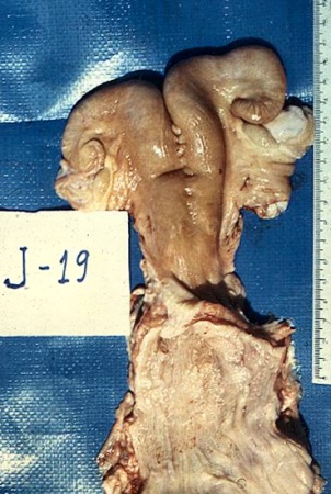 Normal Anestrous Uterus.