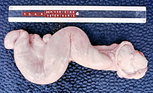 Uterus Unicornis.