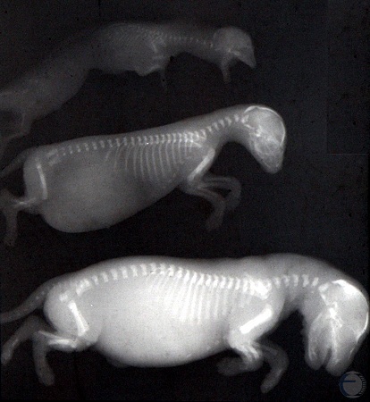 Radiography of Fetuses.