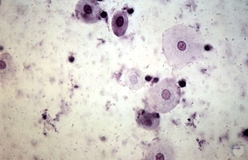 Cytology - Late Metestrus.