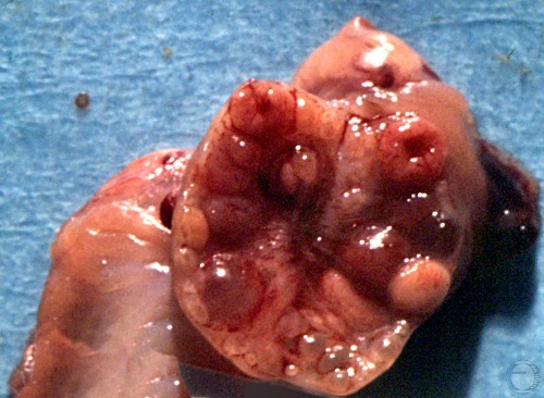 Cross-section of Ovary.