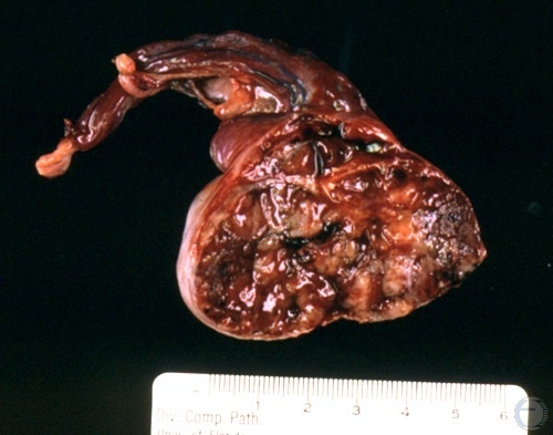 Granuloma Cross-section.