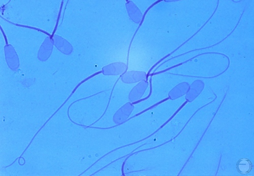 Epididymal Spermatozoa.