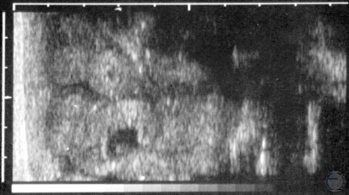 Ultrasonogram in a Pygmy Goat.