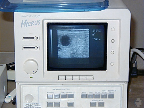 Ultrasound Unit Image.