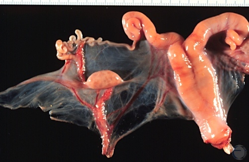 Uterus and Ovary.