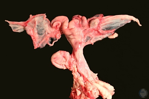 Complete Reproductive Tract.