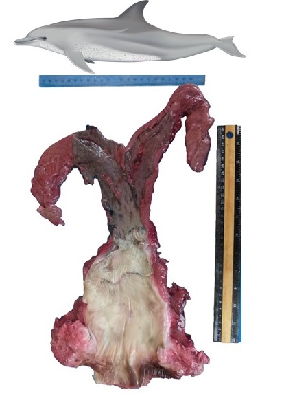 Reproductive Tract