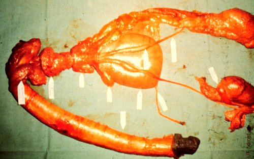 Male Reproductive Tract.
