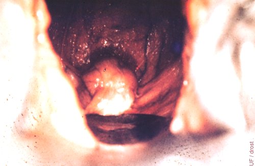 Diestrous Cervix.