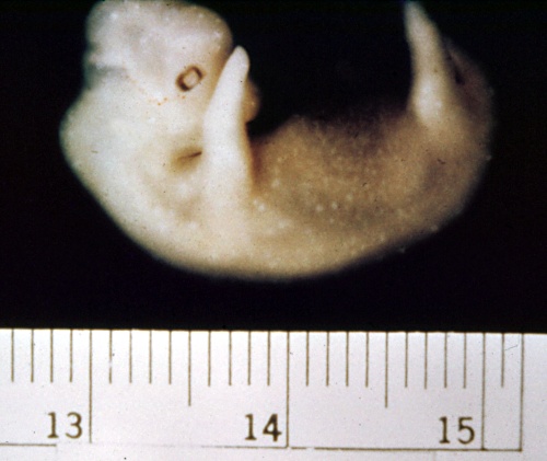 Embryo - 35 Days.
