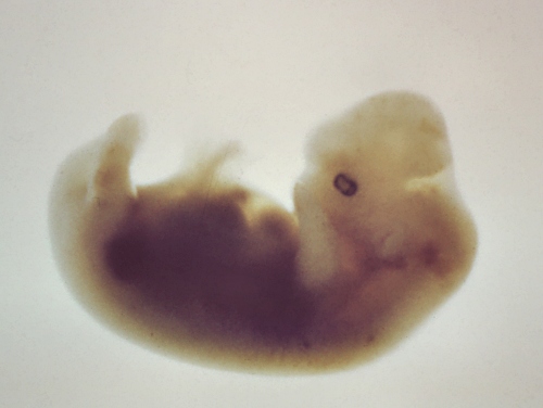 Embryo - 30 Days.
