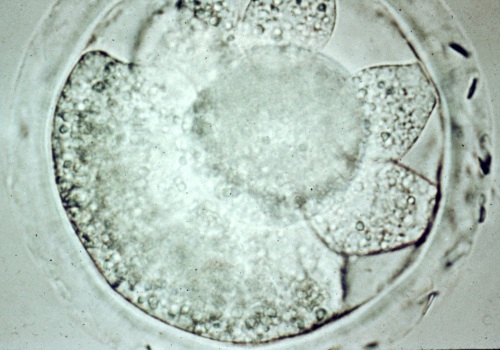 Early Degenerating Embryo.