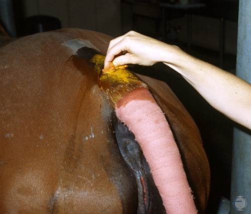 Epidural Anesthesia - Preparation.