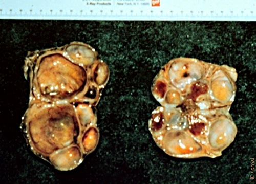 Ovaries with Pyometra.