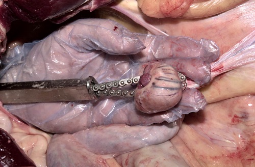 Colpotomy: Chain in Place.