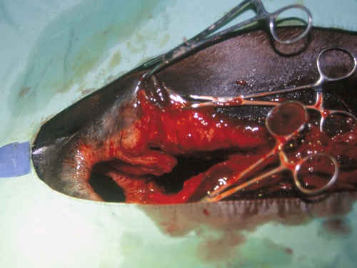 Perineal Laceration Surgery.