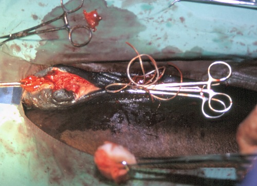 Perineal Laceration Surgery.