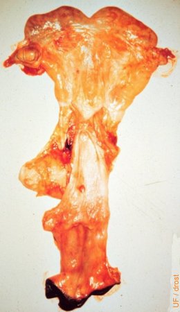 Metestrous Uterus.