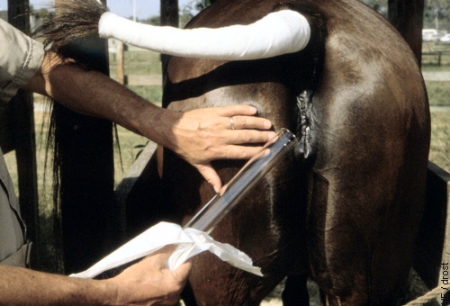 Insertion of the Tube Speculum.