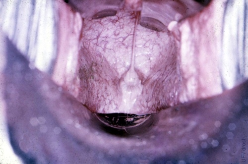 View of an Anestrous Cervix.