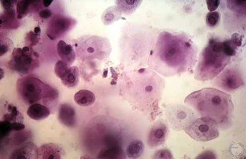 Cytology - Proestrus.