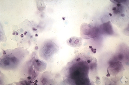 Cytology - Metestrus.