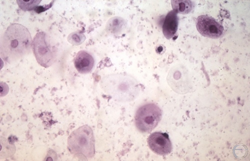 Cytology - Late Anestrus.