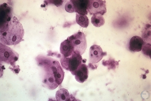 Cytology - Mid Metestrus.