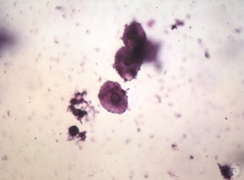 Cytology - Anestrus.