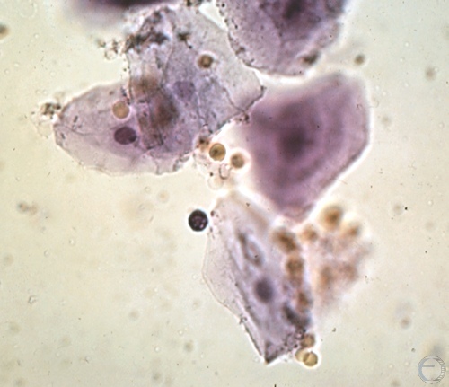 Cytology - Early Estrus.