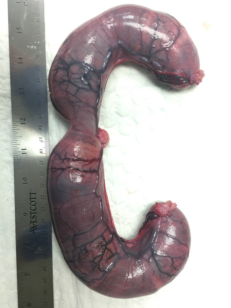 A gravid uterus approximately 50 days gestation.
