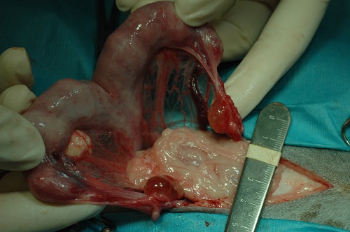 Ovarian Cysts