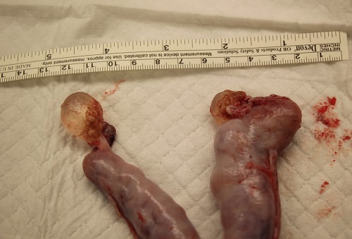 A large cystic follicle is present on both ovaries.