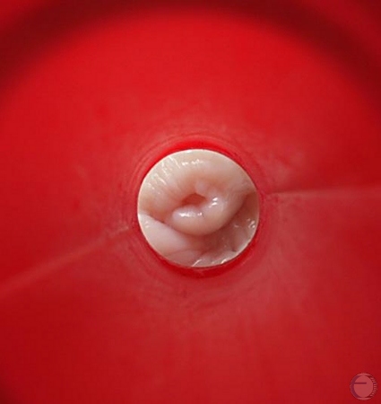 Vaginoscopic View of Cervix.