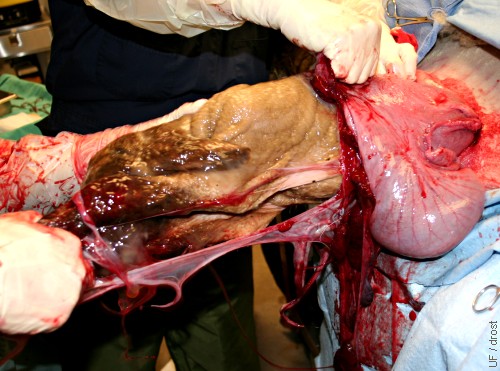 Surgical Delivery of the Lamb.