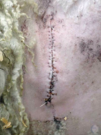 Seroma of the Incision.