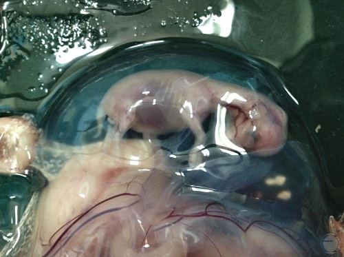 45-Day Fetus.