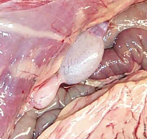 Intra-abdominal Testis - Close-up.