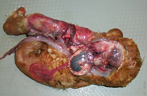 Incomplete Fetus.