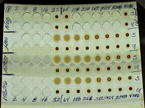 Test Plate for Toxoplasmosis.