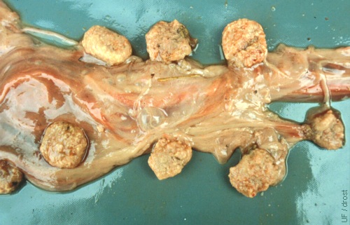 Toxoplasmosis / Placenta.
