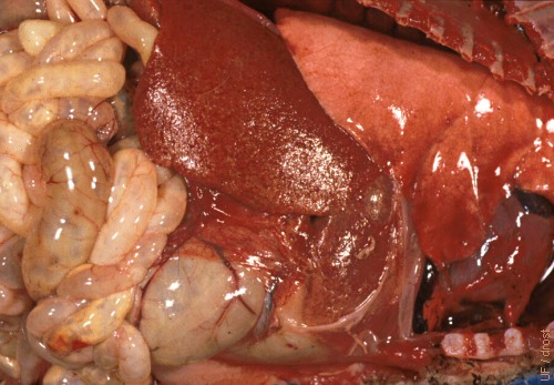 Listeria Liver Lesions.