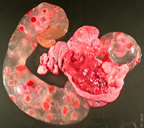 Triplet Placenta.