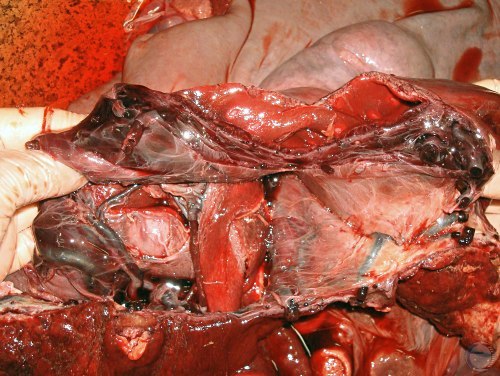 Inside View of the Uterus.