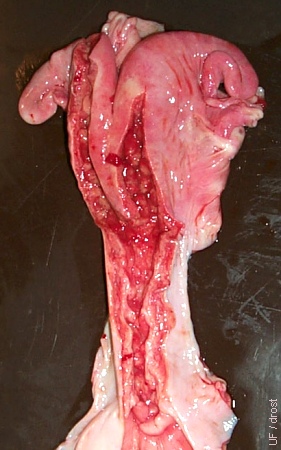 Postpartum Uterus.