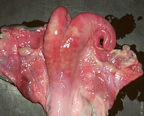 Normal Uterus.