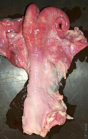 Normal Reproductive Tract.