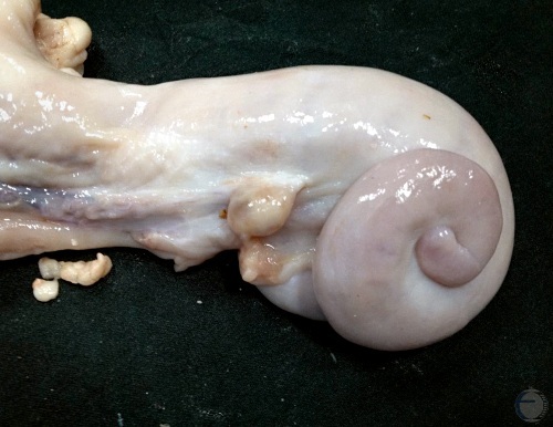 Normal Nongravid Uterus.